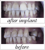 Pailin Dental patient