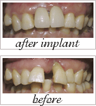 Pailin Dental patient